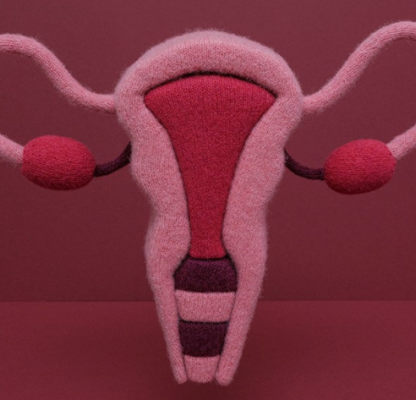 Cervical Cancer